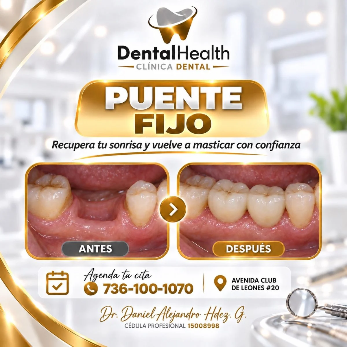 Dentalhealthteloloapan - Foto 7